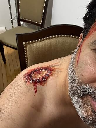 Special effects makeup on Sunil’s shoulder